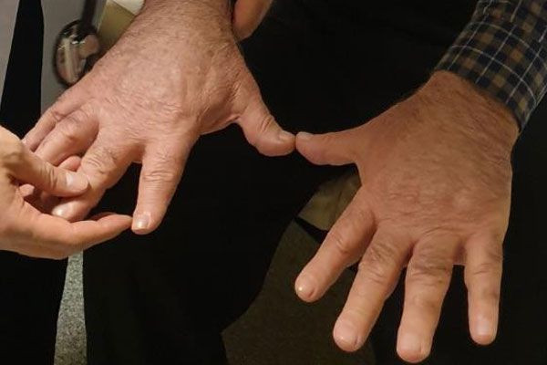 Giresun'da akılalmaz olay dili ve elleri her geçen gün büyüyor - Resim: 3