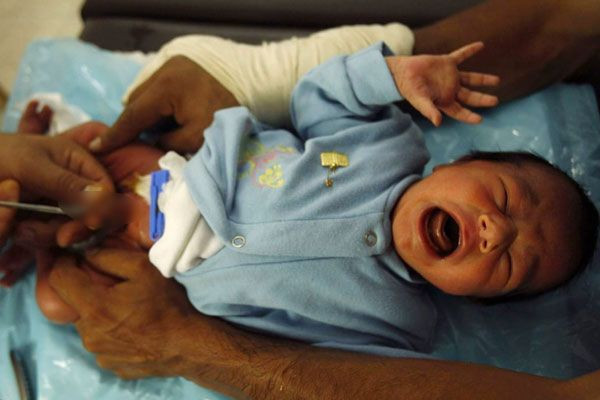 Sünnet hakkında yıllar sonra ortaya çıkan gerçek! Bu dönemde yaptırmak... - Resim: 1