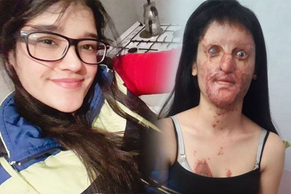 Yardım bekleyen Berfin Özek'e Sağlık Bakanı Fahrettin Koca'dan destek - Resim: 4