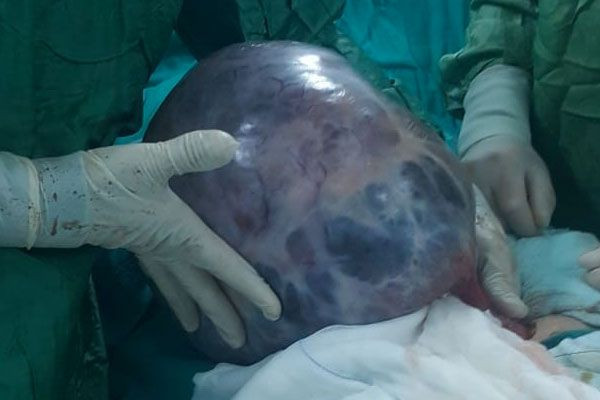 Kabızlık sandı ama gerçek bambaşka çıktı! Karnından alınanlara bakın - Resim: 2