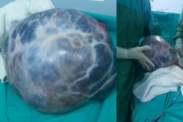 Kabızlık sandı ama gerçek bambaşka çıktı! Karnından alınanlara bakın - Resim: 1