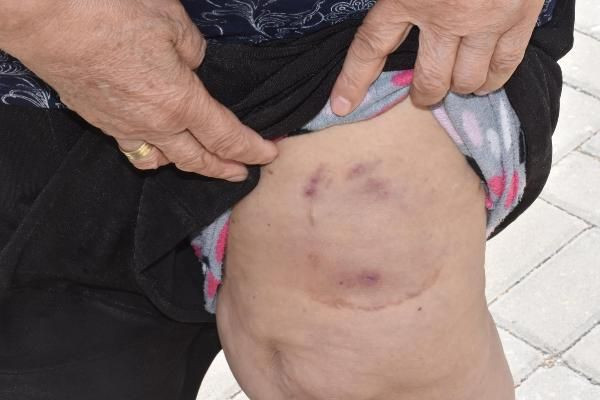 İzmir'de pitbull saldırısına uğrayan yaşlı kadın şaşırttı: Köpeğin bir suçu günahı yok - Resim: 2