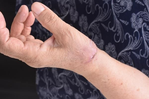 İzmir'de pitbull saldırısına uğrayan yaşlı kadın şaşırttı: Köpeğin bir suçu günahı yok - Resim: 3