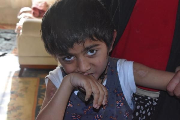 İzmir'de Miraç bebek ellerini ısırmasın diye bebek beziyle bağlıyorlar - Resim: 1