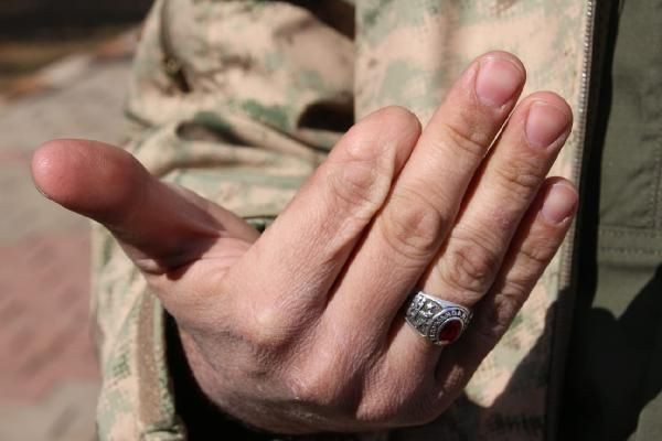 Adana'da 12 yıllık uzman çavuş Selman Gök'ün böbreği başka yerde çıktı - Resim: 2