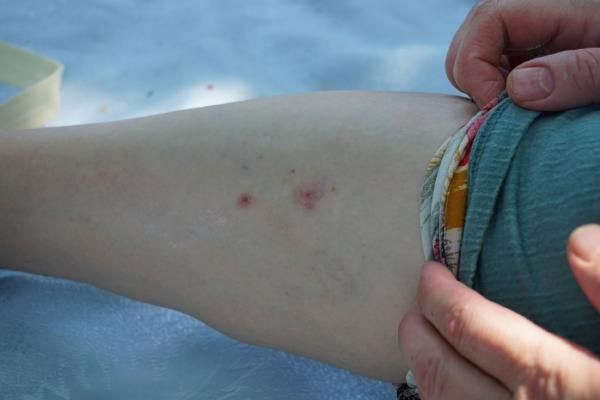 İstanbul'a sivrisinek kabusu: İlaçlara karşı direnç kazandı - Resim: 4