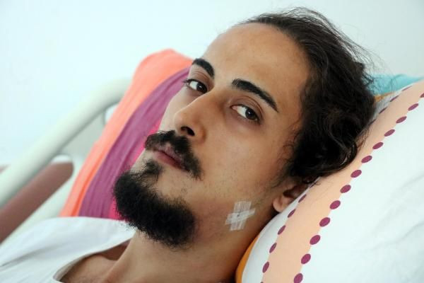 Zonguldak'ta akılalmaz olay! 'Bana da bir şarkı çal' diyerek tıp öğrencisini bu hale getirdiler - Resim: 2