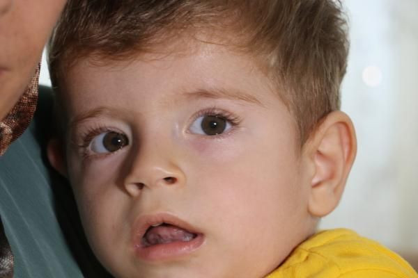 Diyarbakırlı Alperen'in sadece 4 ayı var! Gerekli paranın sadece yüzde 1'i toplandı - Resim: 1