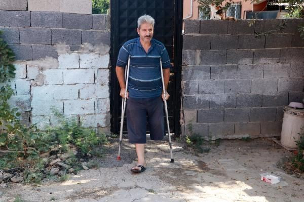 Adana'da budama hastalığı hayatını mahvetti: Bana bakıp ibret alsınlar - Resim: 1