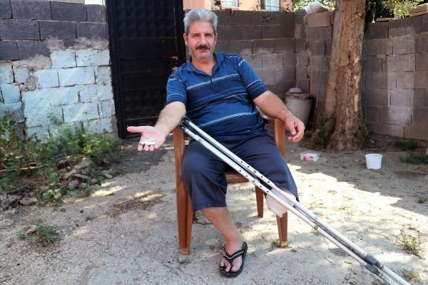 Adana'da budama hastalığı hayatını mahvetti: Bana bakıp ibret alsınlar - Resim: 4