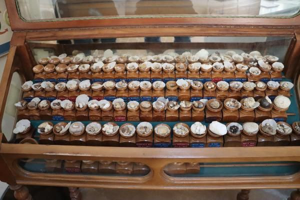 Doktorun şaşırtan böbrek ve idrar taşı koleksiyonu! Kimisi 22 santim, kimisi 650 gram - Resim: 1