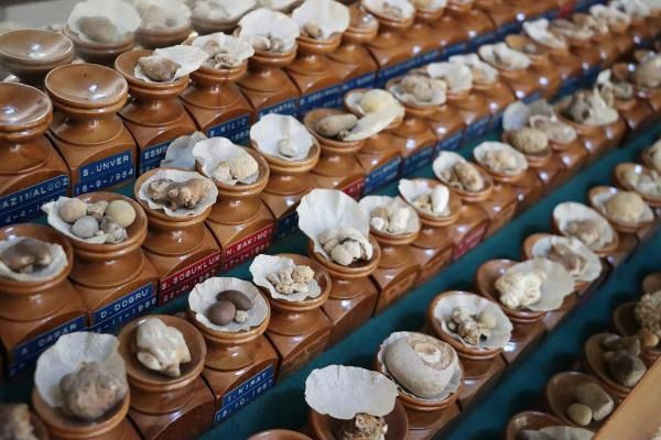 Doktorun şaşırtan böbrek ve idrar taşı koleksiyonu! Kimisi 22 santim, kimisi 650 gram - Resim: 4