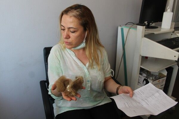 Gaziantep'te küfürler savurup kabusu yaşattı! Saçları avuç dolusu yolundu: Psikolojim çok bozuldu - Resim: 2