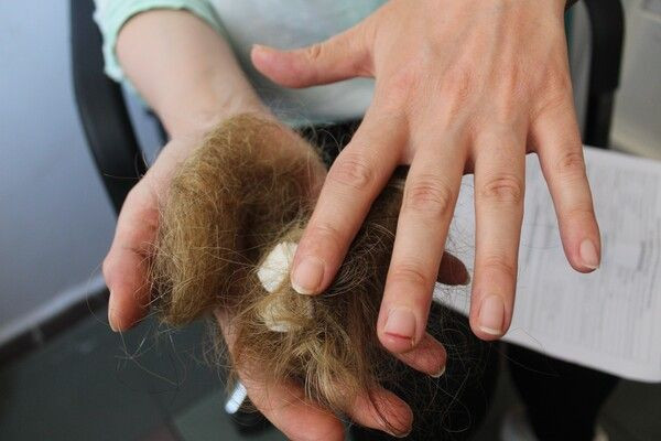 Gaziantep'te küfürler savurup kabusu yaşattı! Saçları avuç dolusu yolundu: Psikolojim çok bozuldu - Resim: 3