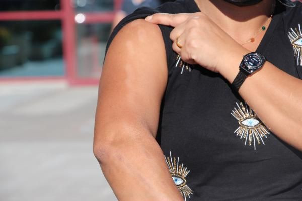 Diyarbakır'da arkadaş tavsiyesiyle gitti dehşeti yaşadı: Herkes 'koluna ne oldu?' diye soruyor - Resim: 2