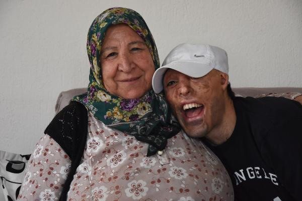 Mehmet Ali'nin ameliyatları koronaya takıldı - Resim: 0