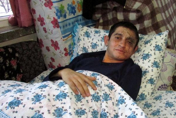 Kayseri'de yaralanan asker o anları anlattı! - Resim: 4