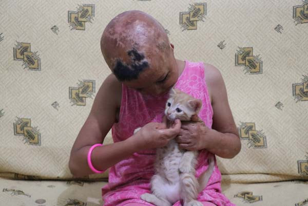 Derisi koyun derisi gibi soyuluyor acılar içinde yaşıyor! - Resim: 1