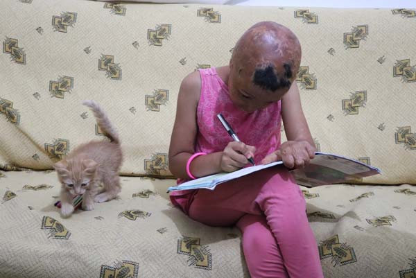 Derisi koyun derisi gibi soyuluyor acılar içinde yaşıyor! - Resim: 2