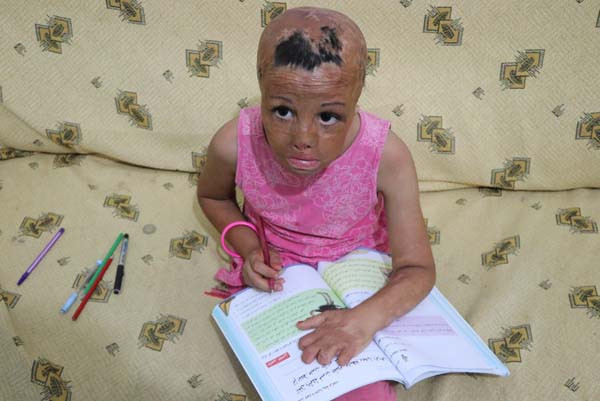 Derisi koyun derisi gibi soyuluyor acılar içinde yaşıyor! - Resim: 3