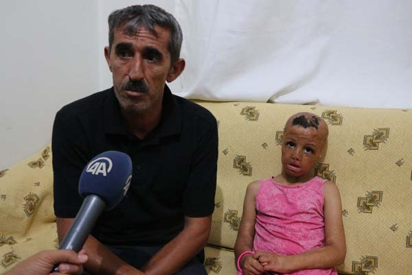 Derisi koyun derisi gibi soyuluyor acılar içinde yaşıyor! - Resim: 4