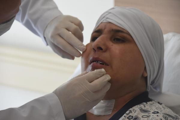 Trafik kazasında yüzü ikiye ayrıldı! 10 saatlik ameliyatla tekrar brleştirildi - Resim: 2