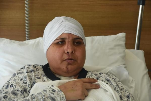 Trafik kazasında yüzü ikiye ayrıldı! 10 saatlik ameliyatla tekrar brleştirildi - Resim: 1