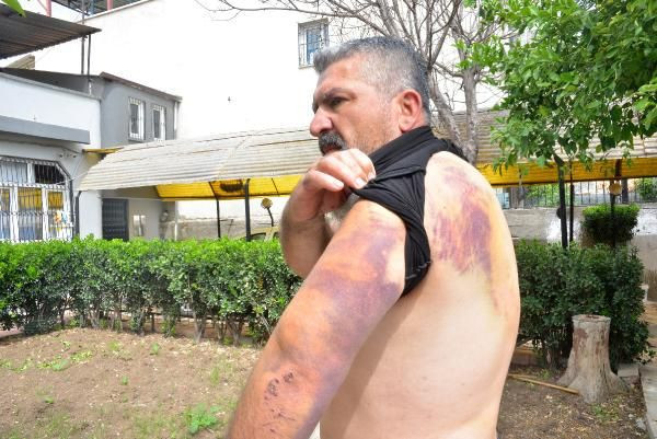 Her satırı dehşet! Çocuklar orakla evimi basıp karnımı deşmek istediler - Resim: 1