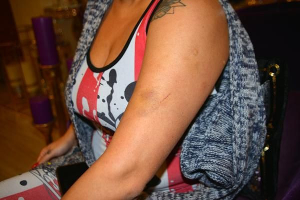 Adana'da eski sevgili dehşeti! Önce tabancayla yaraladı ardından usturayla saldırdı - Resim: 4