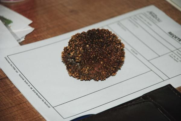 Elazığ'da adamın mesanesinden çıkan şey doktorları şoke etti! - Resim: 1