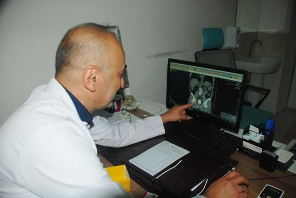 Elazığ'da adamın mesanesinden çıkan şey doktorları şoke etti! - Resim: 3