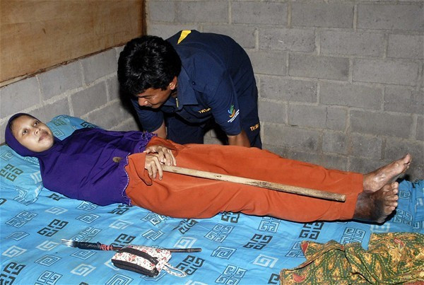 Doktorlar anlam veremedi bir anda alnında çıkana bakın - Resim: 2