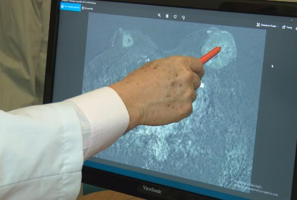 Röntgende tesadüfen çıkıyor: Erkekler bu hastalığı kendilerine konduramıyor - Resim: 0