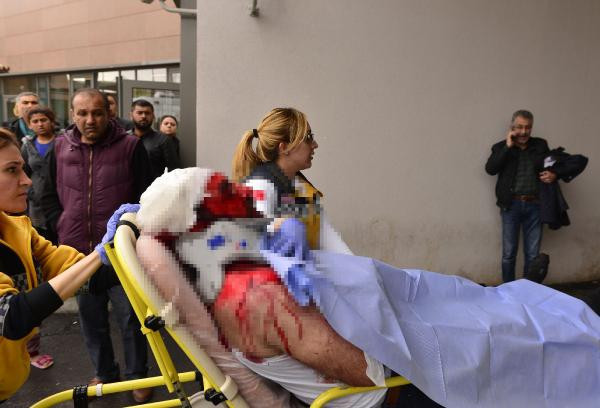 Uyurken yüzüne kızgın yağ döküp satırla vurmuştu! Bakın niye yapmış? - Resim: 1