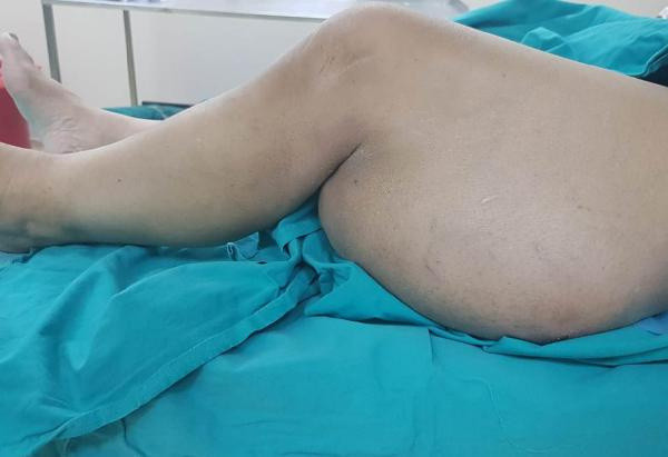 Diyarbakır'da covid-19'dan korktu doktora gidince şok oldu! 4,5 saat sürdü - Resim: 2