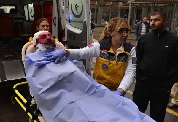 Uyurken yüzüne kızgın yağ döküp satırla vurmuştu! Bakın niye yapmış? - Resim: 3