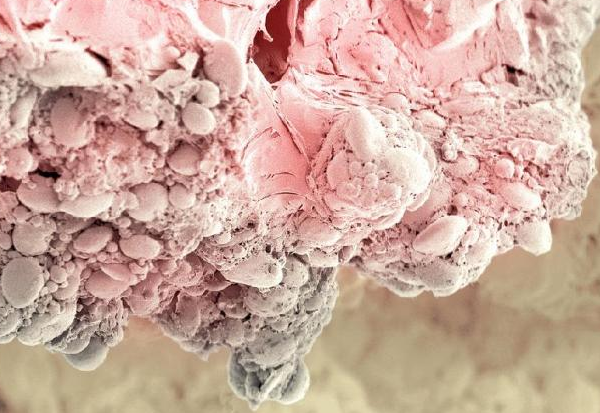 Hiç bu kadar yakından gördünüz mü? - Resim: 1