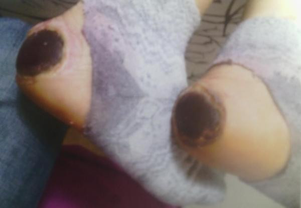 'Topuk yakma' davasında karar! 2 hemşirenin cezası... - Resim: 3