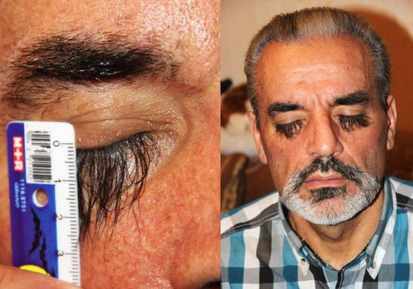 Dünyanın en uzun kirpikli insanı! - Resim: 2