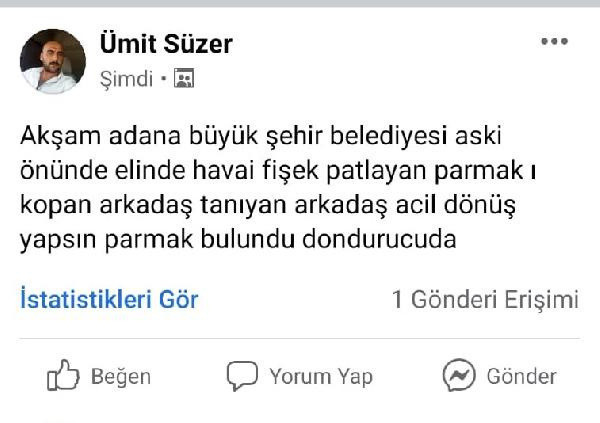 Şampiyonluk kutlamasında havai fişek elinde patlayınca parmakları parçalandı - Resim: 1