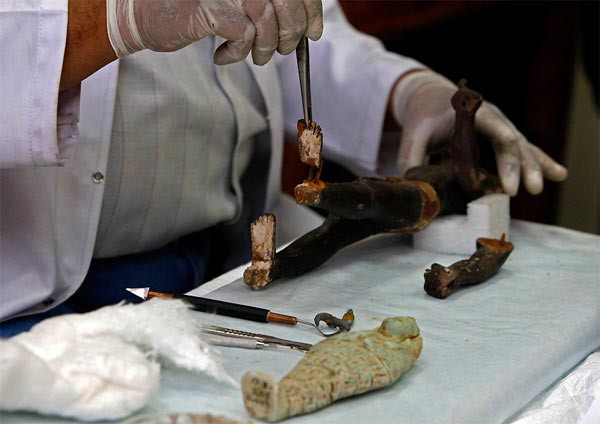 Firavunlar ameliyat masasında! - Resim: 1