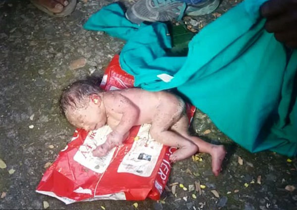 Çöpte dehşete düşüren görüntü vücuduna baktılarında ise... - Resim: 1