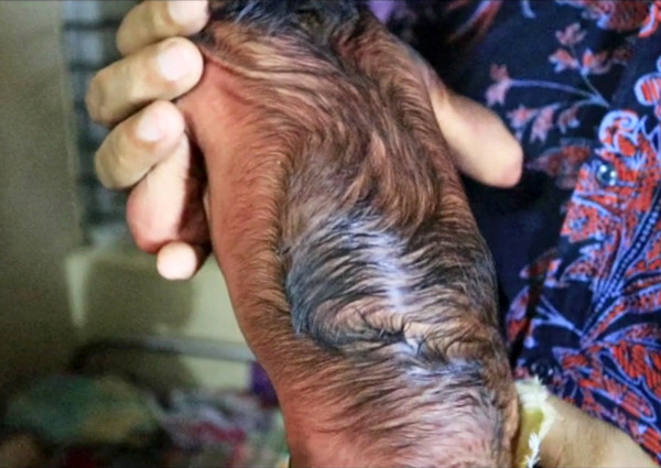 Bebek bu halde dünyaya geldi görenlerin ağzı açık kaldı - Resim: 4