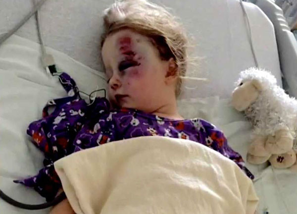 Anne küçük kızını bu halde buldu sebebi ise kendisiydi - Resim: 3