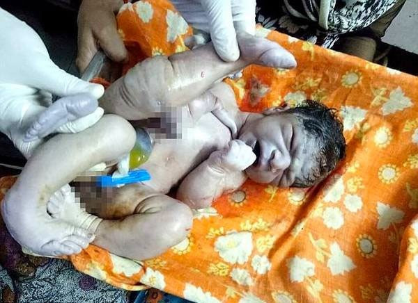 Bebek bu halde doğdu ailesi onu korkunç şekilde öldürmek istedi  - Resim: 2