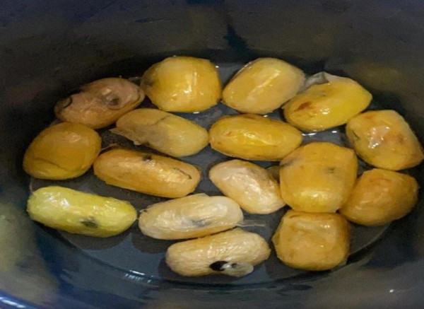 Muş'ta muayene sırasında ortaya çıktı! Midesinden çıkanlar şok etti - Resim: 1