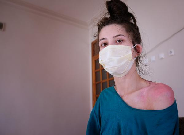 Konya'da eşiyle kızını kaynar suyla haşladı! Sözleri pes dedirtti: Aldığı ceza şaşırttı - Resim: 0