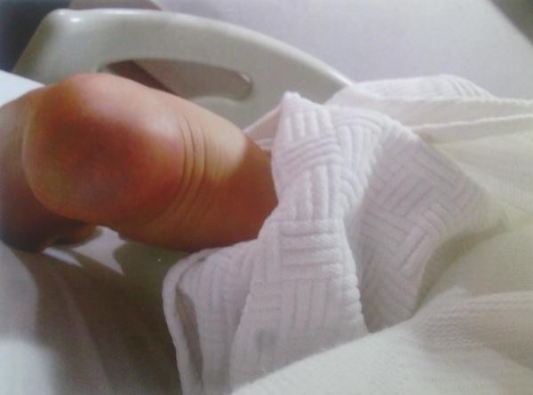 'Topuk yakma' davasında karar! 2 hemşirenin cezası... - Resim: 4