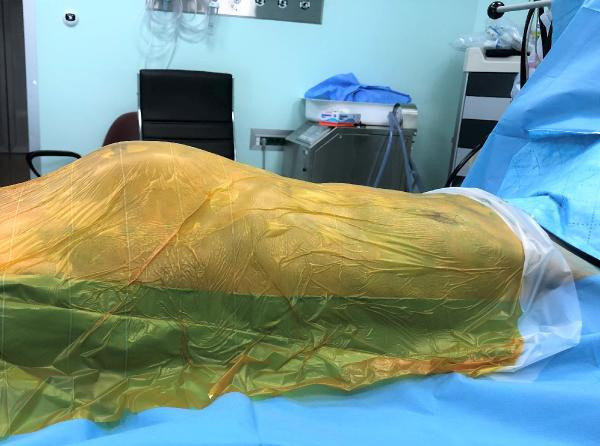 İstanbul'da doktorlar şok oldu literatüre girecek: Saatli bombayla yaşamış - Resim: 2