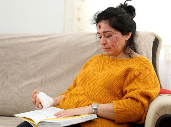 Çok nadir görülüyor! Kimse soru sormasın diye dışarı çıkamıyor - Resim: 3